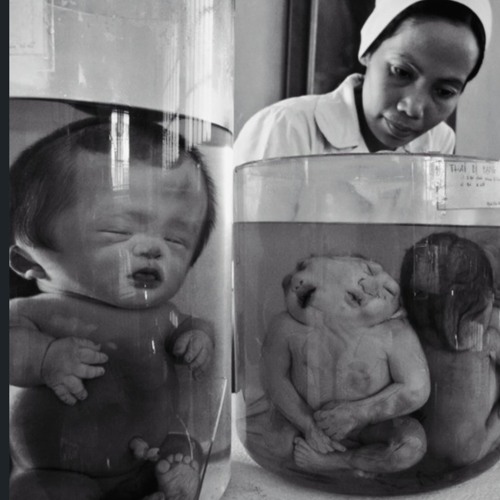 black-and-white photo of preserved infants in glass specimen jars, a nurse behind them