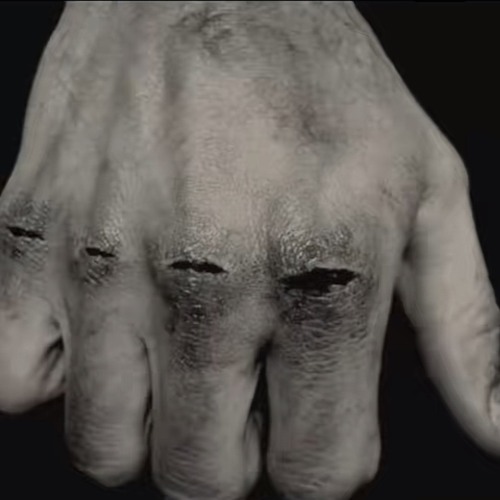the back of a pale hand with dark, scabbed knuckles